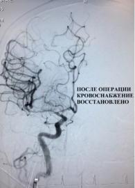 ПОСЛЕ ОПЕРАЦИИ
