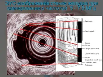 Ультрасонография 4
