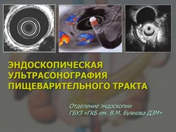Заставка - Ультрасонография