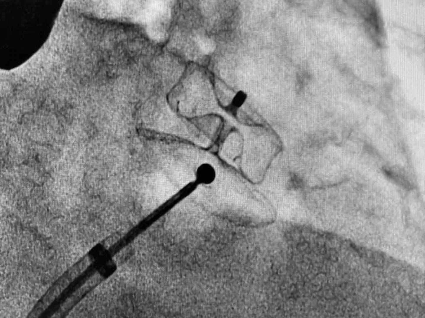 photo_5359411431088444098_y